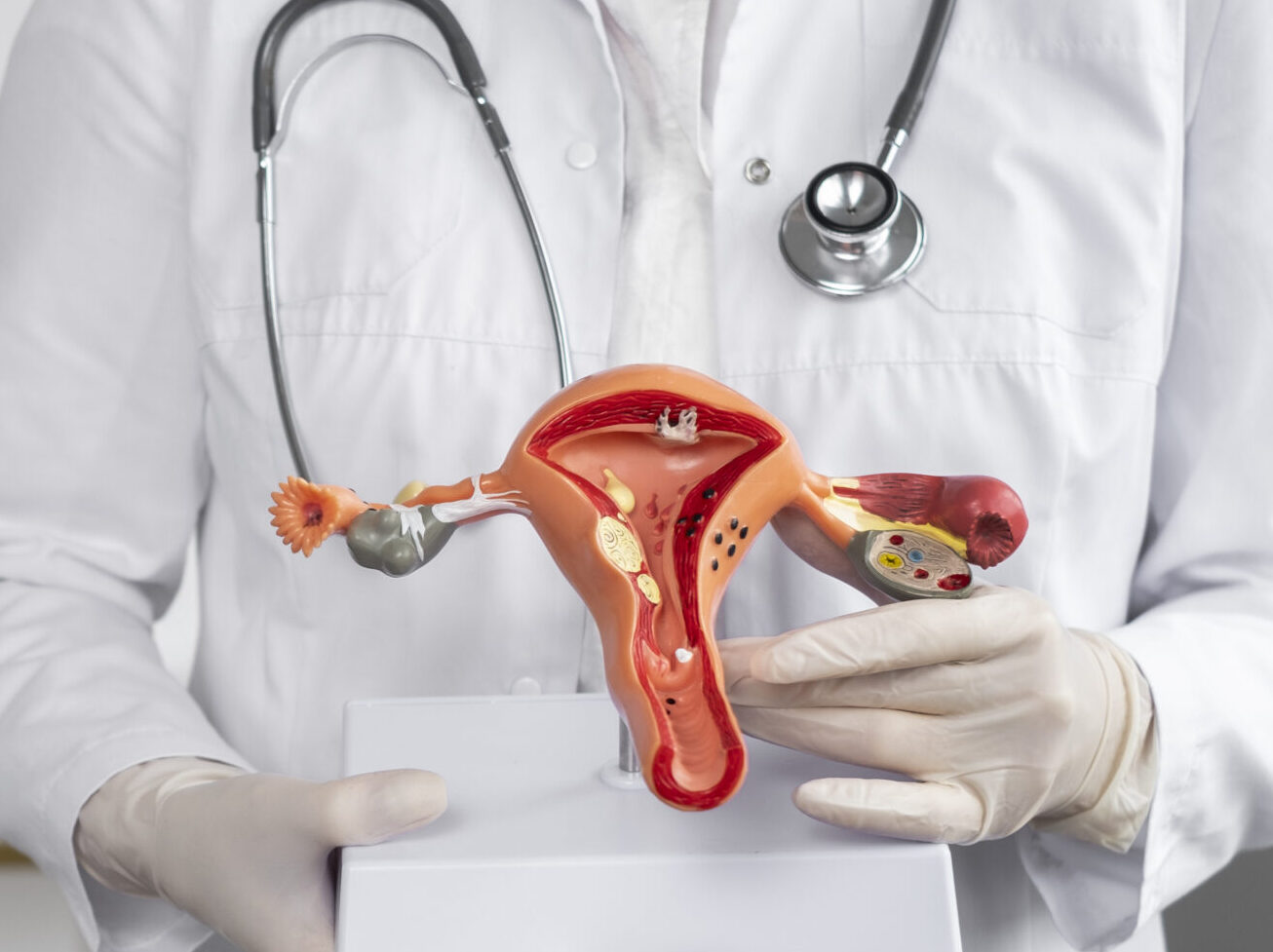 Urgência ou aumento da frequência urinária